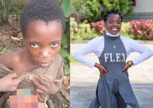 Mary Odiong - Before and After